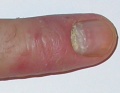 Miniatyrbilde av versjonen fra 1. des. 2010 kl. 18:17