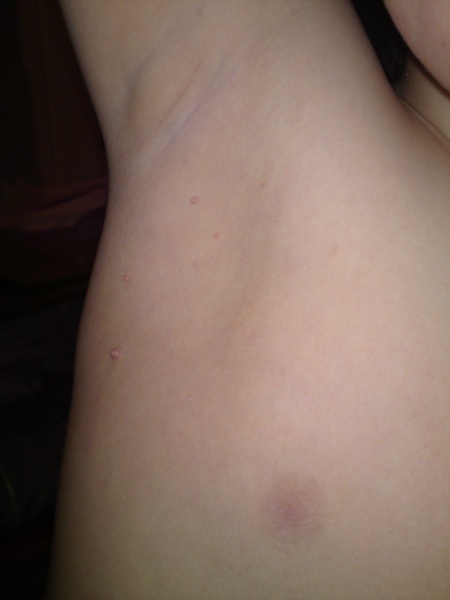 Fil:Bilder kevin arm 006.jpg